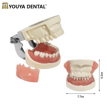 Zubné Ambulancie Model Absces Rez Odvodnenie Model S Vymeniteľné Typodont Zuby Stomatológia Zariadenia Zubár Študent Školenia